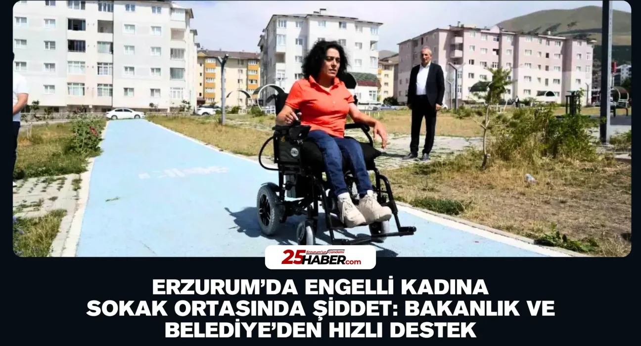 Erzurum’da Engelli Kadına Sokak Ortasında Şiddet: Bakanlık ve Belediye’den Hızlı Destek